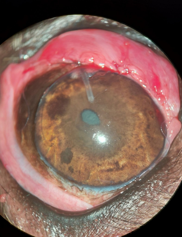 Glaucoma Ocular Canino Lago Sul - Glaucoma de Cachorro Barreiros