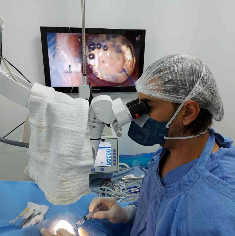 Operação de Catarata em Cachorro ZV Zona Verde - Catarata Gato Cirurgia
